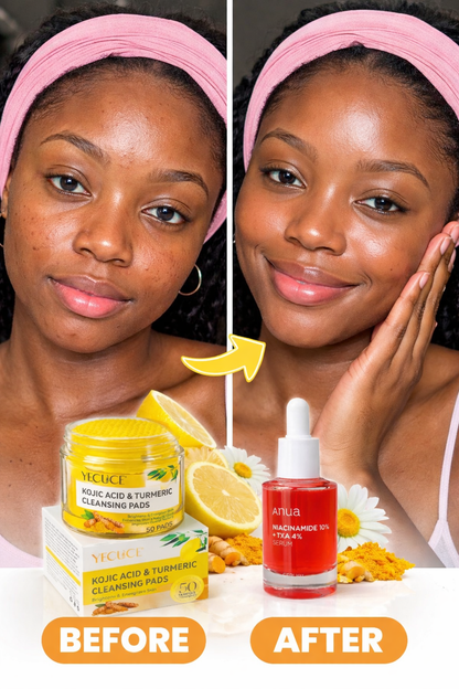 🔥 “Kojic Acid & Turmeric + Niacinamide 10% : Le duo ultime contre les taches !”